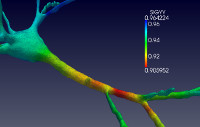 Numerical simulation of a neuron